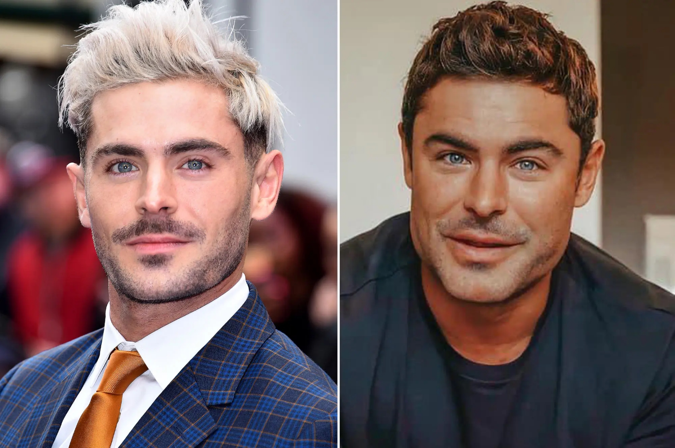 2022-10-27 23_47_41-zac-efron-plastic-surgery.jpg (Image WEBP, 2000 × 1333 pixels) - Redimensionnée .jpg